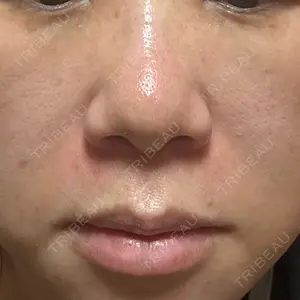 プライベートスキンクリニック 梅田本院口コミ