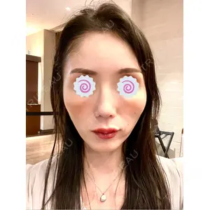 東京シルククリニック 東京シルククリニック 東京神田院口コミ