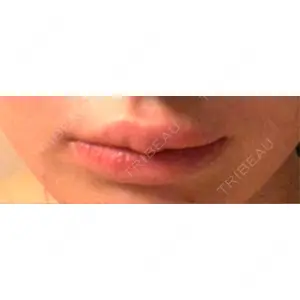 アリエル美容クリニック アリエル美容クリニック 横浜院口コミ