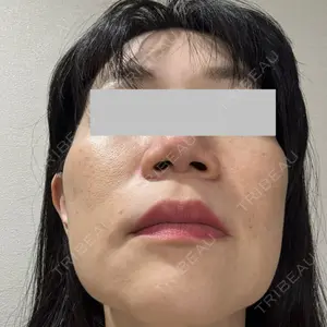 ルラ美容クリニック ルラ美容クリニック 広島院口コミ