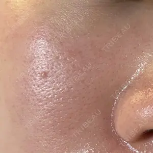 Natural Skin Clinic Natural Skin Clinic 笹塚院口コミ