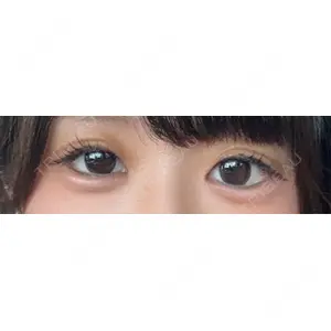 LOUIS CLINIC 二子玉川院【ルイクリニック】口コミ