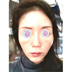 東京シルククリニック 東京シルククリニック 東京神田院口コミ