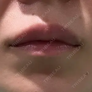 アリエル美容クリニック アリエル美容クリニック 横浜院口コミ