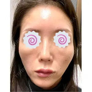 東京シルククリニック 東京シルククリニック 東京神田院口コミ