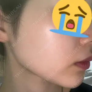 CZEN CLINIC 銀座院口コミ