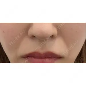 TCB東京中央美容外科 TCB東京中央美容外科 名古屋栄院口コミ