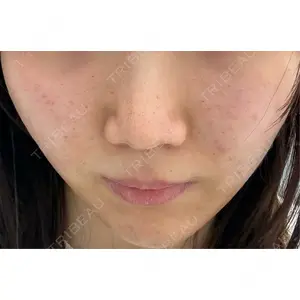 CZEN CLINIC 銀座院口コミ