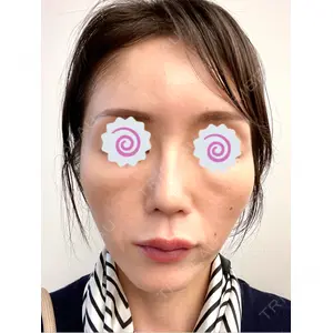 東京シルククリニック 東京シルククリニック 東京神田院口コミ