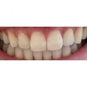 アンデルト歯科・矯正歯科口コミ