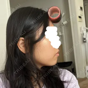 PureMe Skin Clinic（ピュアミースキンクリニック麻布）口コミ