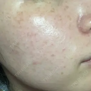 スマートスキンクリニック スマートスキンクリニック 神保町院口コミ