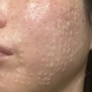 スマートスキンクリニック スマートスキンクリニック 神保町院口コミ