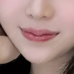 口コミ