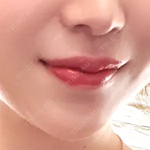 口コミ
