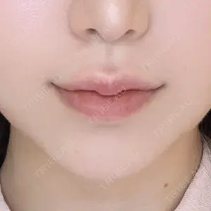 口コミ