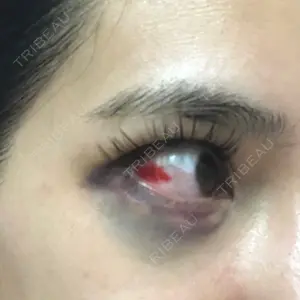 TCB東京中央美容外科 TCB東京中央美容外科 新宿東口院口コミ