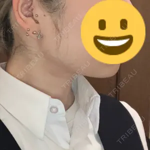 A CLINIC（エークリニック） A CLINIC（エークリニック） 池袋院口コミ