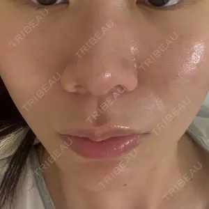 東京シルククリニック 東京シルククリニック 東京神田院口コミ