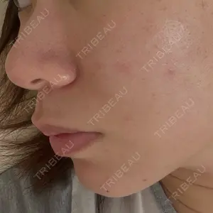 東京シルククリニック 東京シルククリニック 東京神田院口コミ