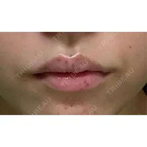 アリエル美容クリニック アリエル美容クリニック 横浜院口コミ