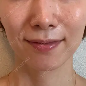 CZEN CLINIC 銀座院口コミ