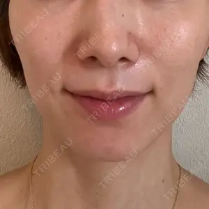 CZEN CLINIC 銀座院口コミ
