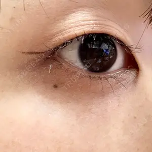 ヴァージンクリニック ヴァージンクリニック 広島院口コミ