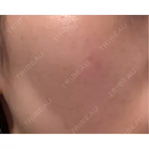 L‘amour clinic Tokyo【ラムールクリニック東京】口コミ