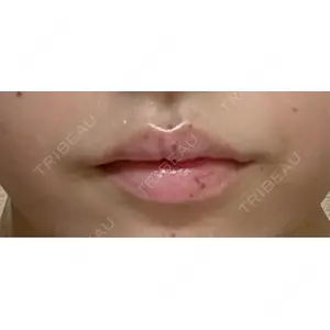 アリエル美容クリニック アリエル美容クリニック 横浜院口コミ