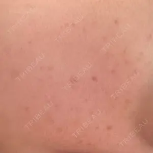 ON-CLINIC Beauty口コミ