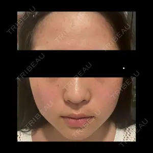 HINATA クリニック口コミ