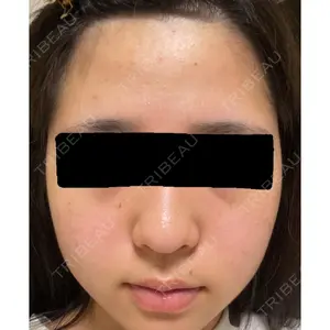 HINATA クリニック口コミ