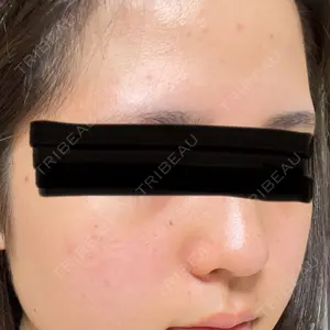 HINATA クリニック口コミ