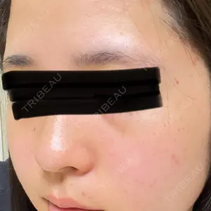 HINATA クリニック口コミ