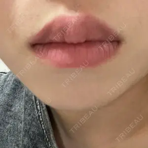 アリエル美容クリニック アリエル美容クリニック 横浜院口コミ