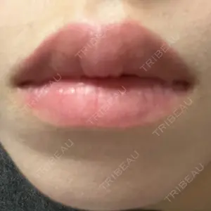 アリエル美容クリニック アリエル美容クリニック 横浜院口コミ