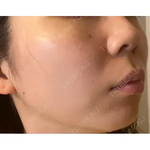 APスキンクリニック銀座口コミ