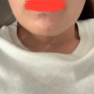 日本美容・医療クリニック 日本美容・医療クリニック 六本木院口コミ