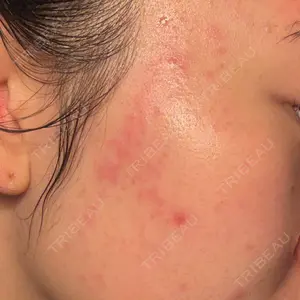 ルラ美容クリニック ルラ美容クリニック 大宮院 / ルラスキンクリニック 大宮院口コミ