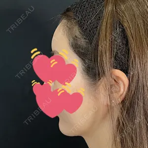 藤・ナチュレ美容クリニック 藤・ナチュレ美容クリニック 銀座院口コミ