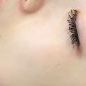 HINATA クリニック口コミ