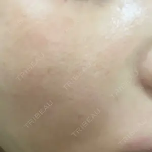 東京シルククリニック 東京シルククリニック 東京神田院口コミ