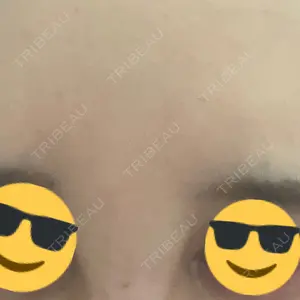 東京シルククリニック 東京シルククリニック 東京神田院口コミ