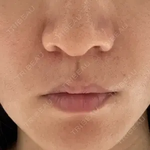 湘南美容クリニック 湘南美容クリニック 福岡院口コミ