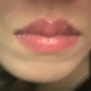 アリエル美容クリニック アリエル美容クリニック 横浜院口コミ