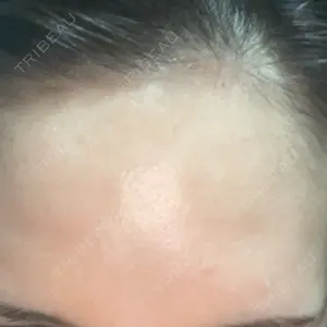 東京シルククリニック 東京シルククリニック 東京神田院口コミ