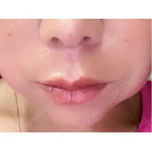 PRISM Beauty Clinic  PRISM Beauty Clinic 町田院口コミ