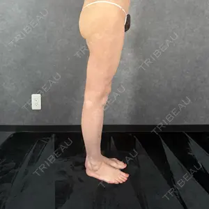 AVAN TOKYO 銀座脂肪吸引 クリニックの