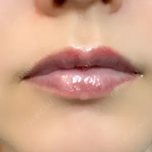 ルーチェクリニック ルーチェクリニック 銀座院口コミ